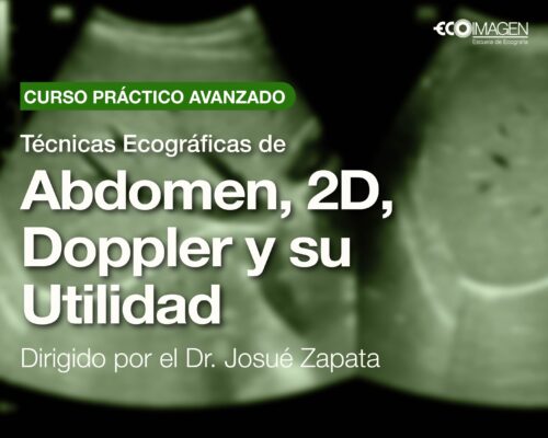 Curso Práctico Avanzado | Técnicas Ecográficas de Abdomen 2D, Doppler y su Utilidad | JUL 2025