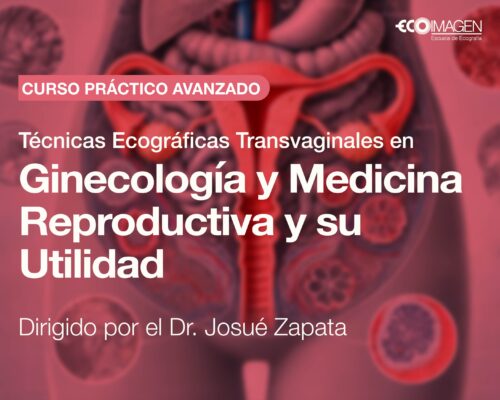 Cursos Prácticos | Técnicas Ecográficas Transvaginales en Ginecología y Medicina Reproductiva y su Utilidad | JUN 2025