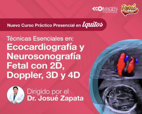 Curso Presencial | Técnicas Esenciales en Ecocardiografía y Neurosonografía Fetal con 2D, Doppler, 3D y 4D | Iquitos JUL 2025