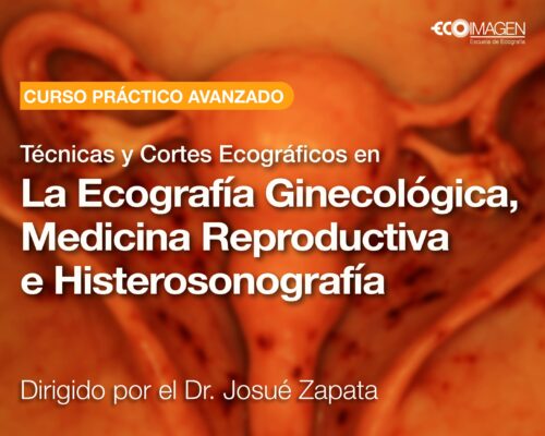Cursos Prácticos | Técnicas y Cortes Ecográficos en la Ecografía Ginecológica, Medicina Reproductiva e Histerosonografía | SEP 2025