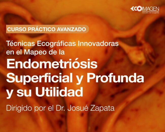 Curso Práctico: Técnicas Ecográficas Innovadoras en el mapeo de la Endometriosis Superficial y Profunda y su Utilidad | Mayo 2025