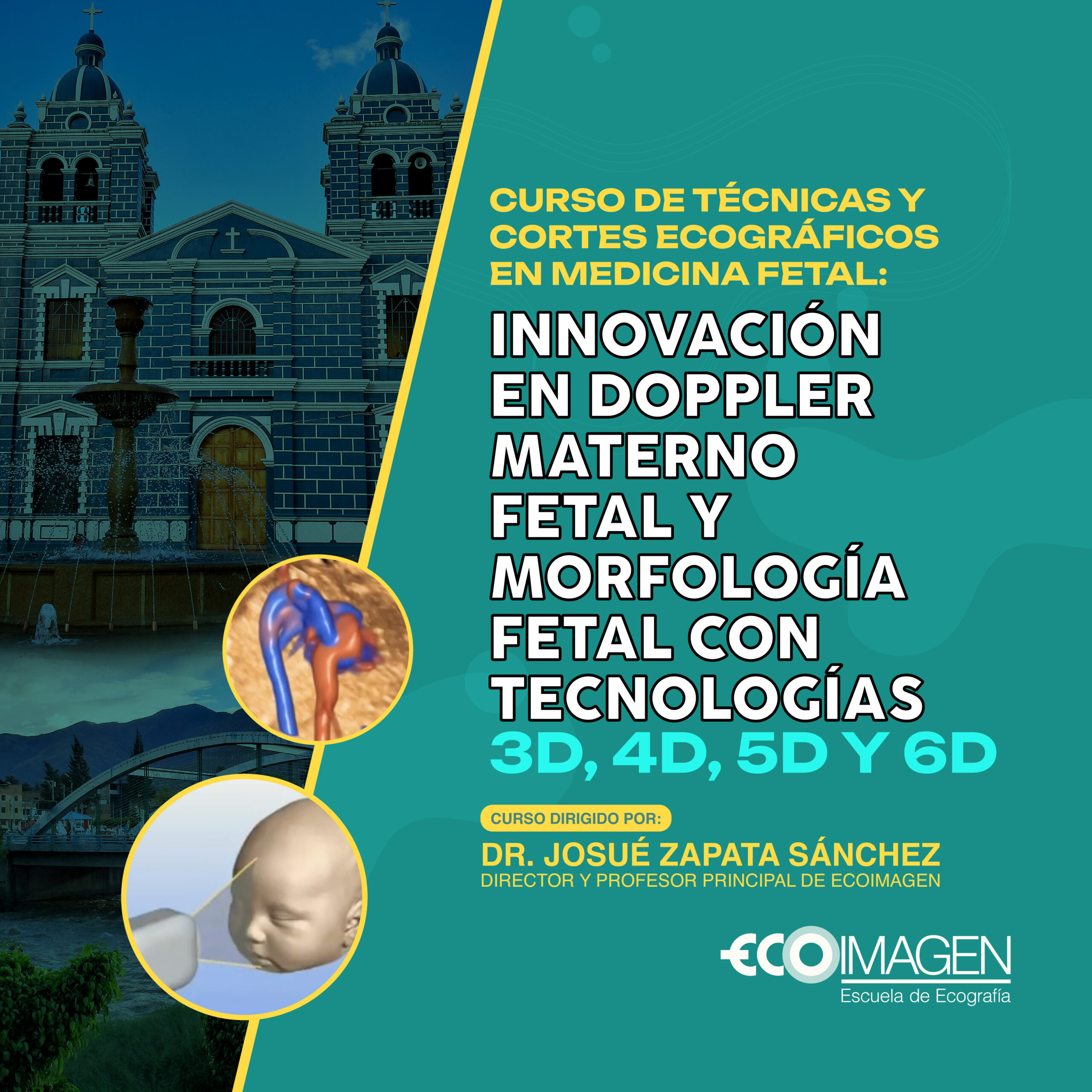 Técnicas Ecográficas en Medicina Fetal: Innovación en Doppler Materno Fetal y Morfología Fetal con Tecnología 3D, 4D, 5D y 6D | Huanuco 2025