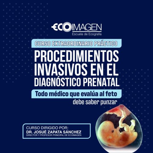 Curso Práctico | Técnicas Ecográficas en Procedimiento Invasivos en el Diagnóstico Prenatal | Noviembre 2025