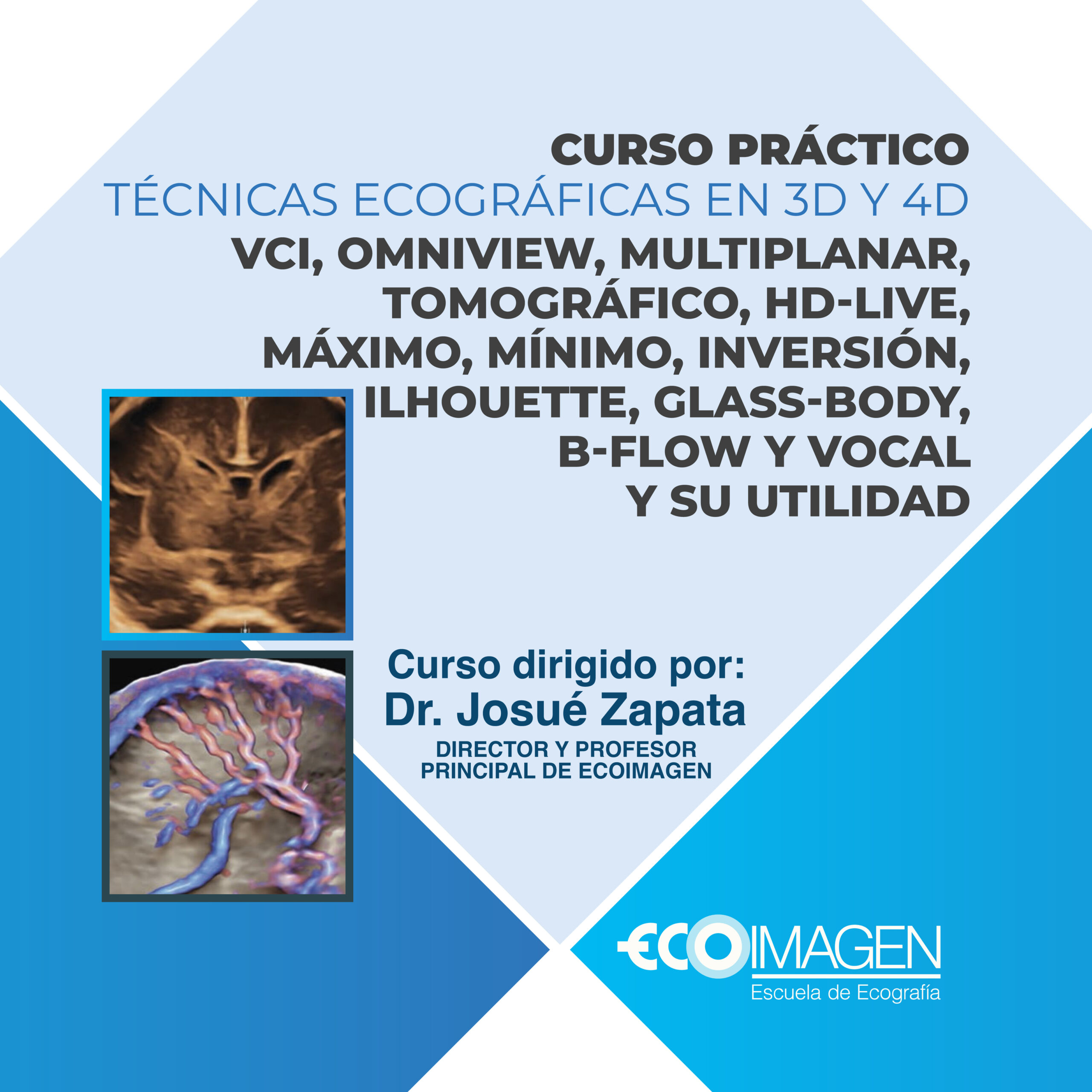 Curso Práctico | Nuevas Técnicas Ecográficas en 3D y 4D: VCI, Omniview, Multiplanar, Tomográfico, HD-Live, Máximo, Mínimo, Inversión, Silhouette, Glass-Body, B-Flow y Vocal y su Utilidad | Noviembre 2025