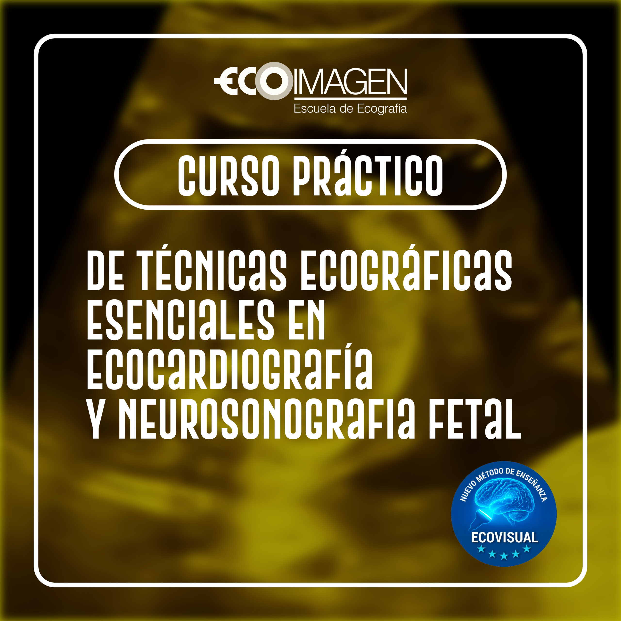 Curso Práctico | Técnicas Ecográficas Esenciales en Ecocardiografía y Neurosonografía Fetal con el Método EcoVisual | 2026