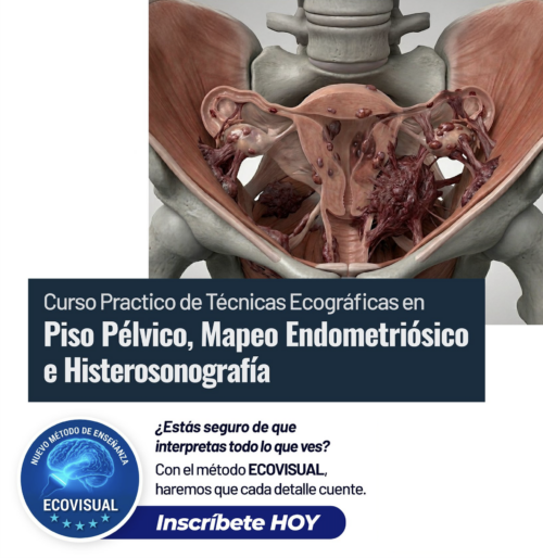 Curso Práctico | Técnicas Ecográficas en Piso Pélvico, Mapeo endometriósico e Histerosonografía | 2026