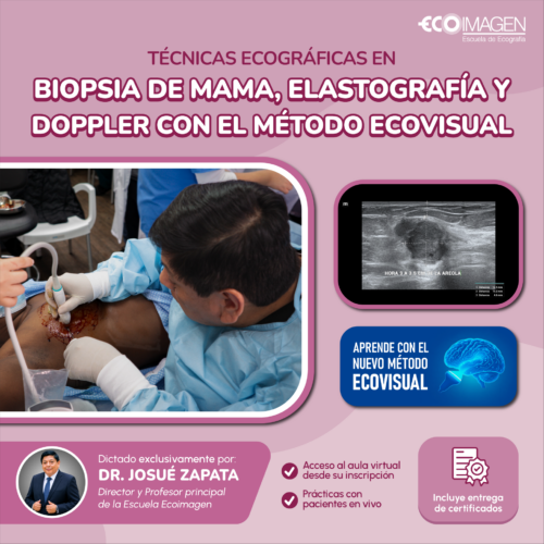 Curso Práctico | Técnicas Ecográficas en Biopsia de Mama, Elastografía y Doppler con el método Ecovisual