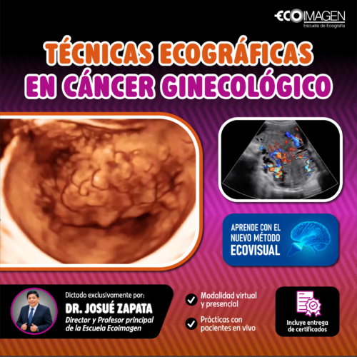 Curso Práctico | Técnicas Ecográficas en Cáncer Ginecológico